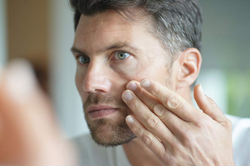 Botox for men