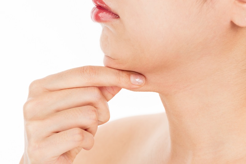 CoolSculpting treatment for double chin